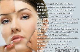 Пигментация кожи на лице: виды и способы лечения Появление пигментации